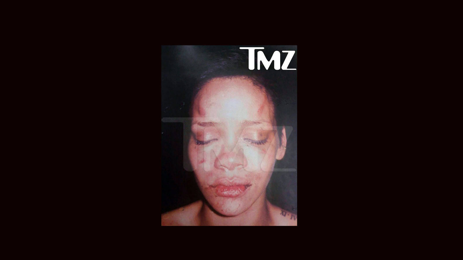 
Las imágenes de cómo quedó la cara de Rihanna tras la paliza de su novio

